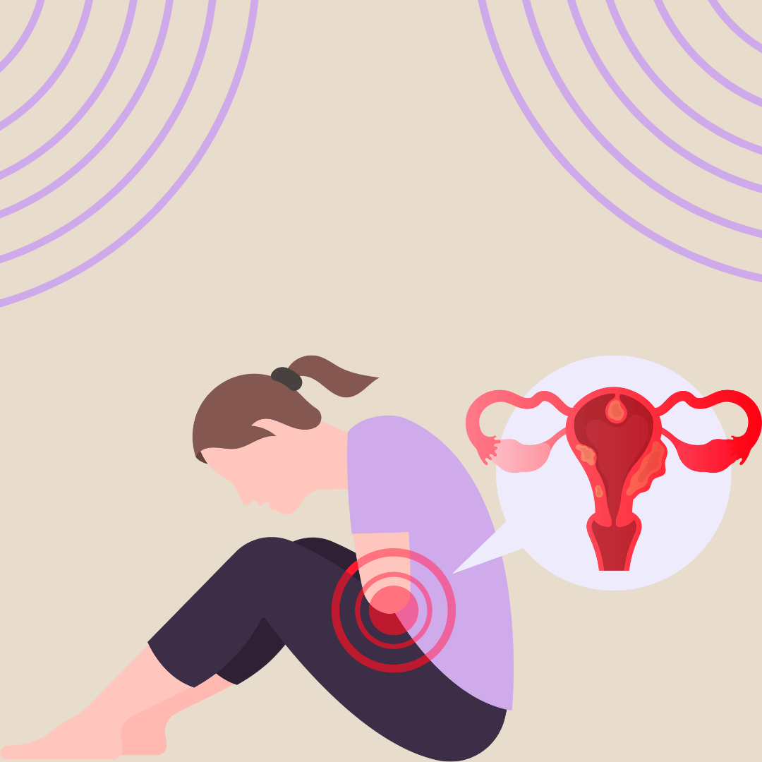 Endometriosis symptoms, signs, and diagnosis