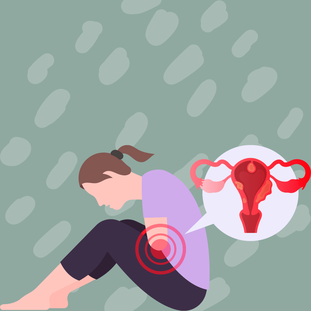Endometriosis 101: definition, causes, risk factors, and staging